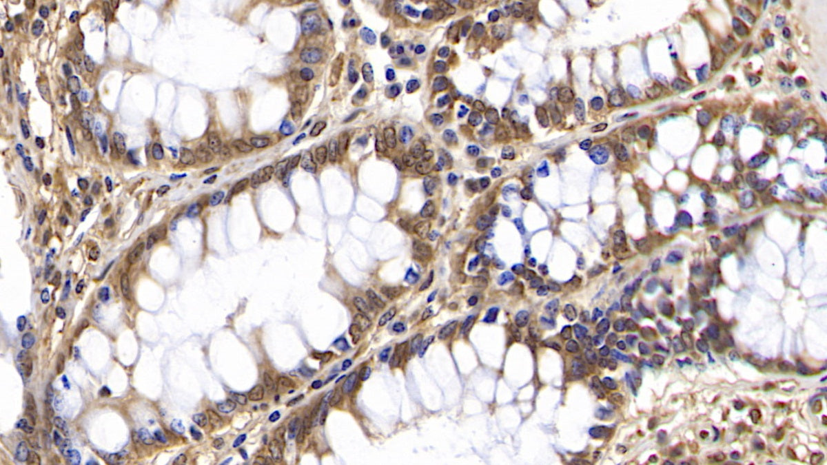 DAB staining on IHC-P; Samples: Human Cerebrum Tissue;  Primary Ab: 40µg/ml Mouse Anti-Human OAS2 Antibody Second Ab: 2µg/mL HRP-Linked Caprine Anti-Mouse IgG Polyclonal Antibody
