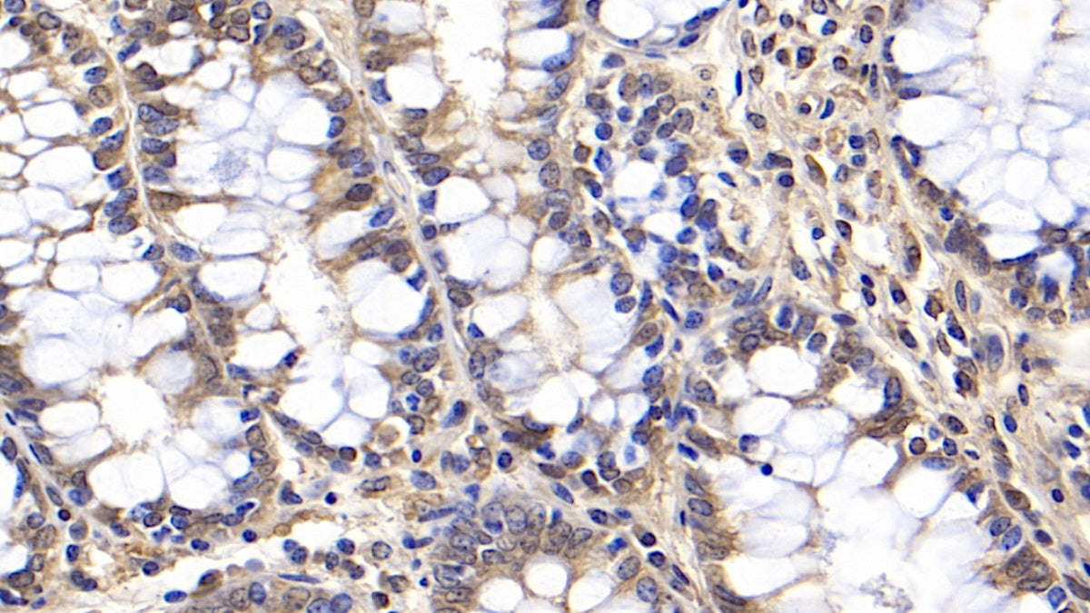2',5'-Oligoadenylate Synthetase 2 (OAS2) Monoclonal Antibody - image 4