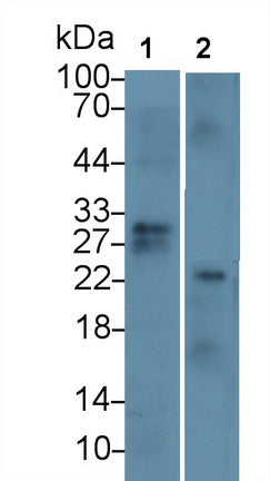 Cluster Of Differentiation 8a (CD8a) Monoclonal Antibody - image 2