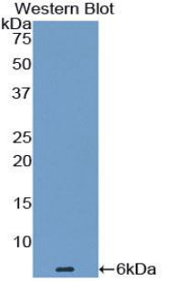 Endothelin 1 (EDN1) Monoclonal Antibody - image 2