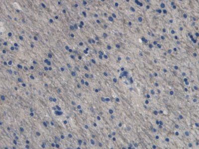 Endothelin 1 (EDN1) Monoclonal Antibody - image 4