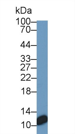 S100 Calcium Binding Protein (S100) Monoclonal Antibody - image 2