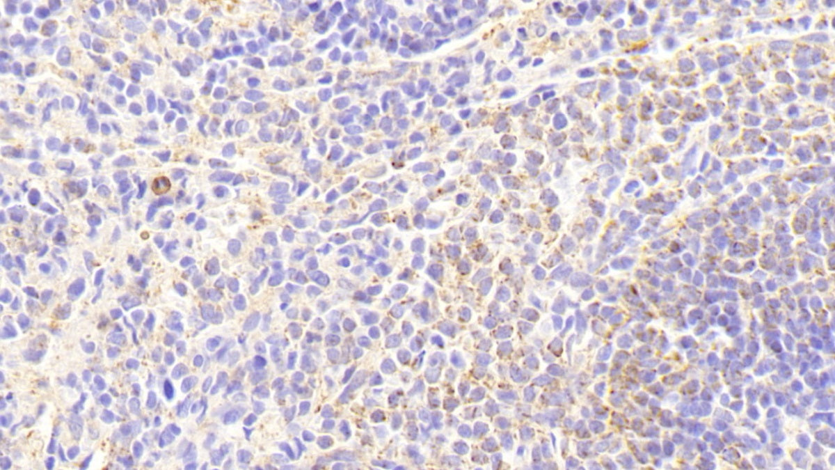 Interleukin 18 (IL18) Monoclonal Antibody - image 3