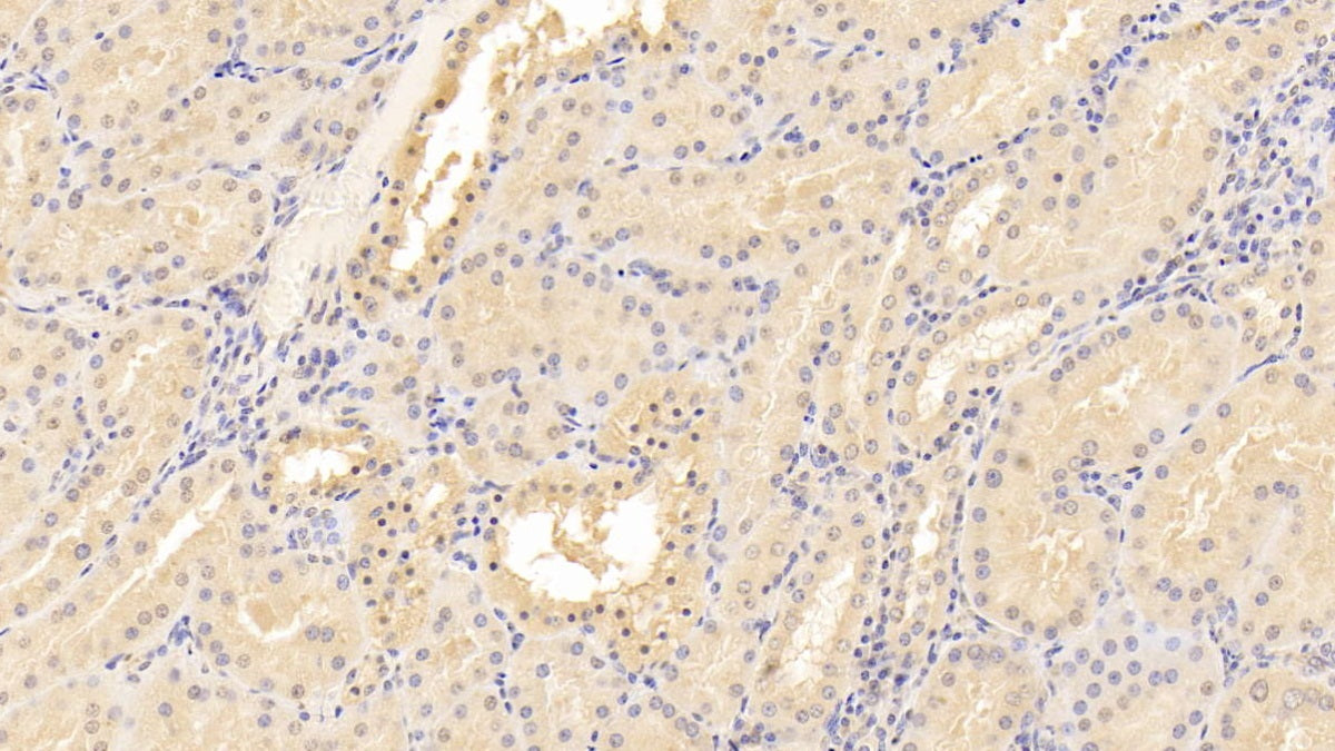 DAB staining on IHC-P; Samples: Human Cardiac Muscle Tissue;  Primary Ab: 10µg/ml Mouse Anti-Human CD40L Antibody Second Ab: 2µg/mL HRP-Linked Caprine Anti-Mouse IgG Polyclonal Antibody