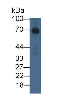 Alpha-Fetoprotein (AFP) Monoclonal Antibody - image 2