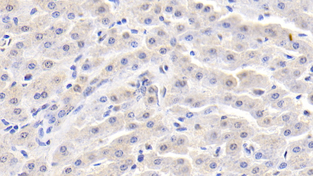 Alpha-Fetoprotein (AFP) Monoclonal Antibody - image 3