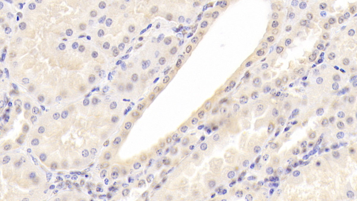 Alpha 2-Antiplasmin (a2PI) Monoclonal Antibody - image 3