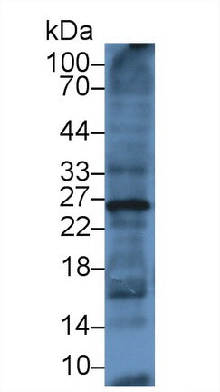 Ubiquitin (Ub) Monoclonal Antibody - image 2