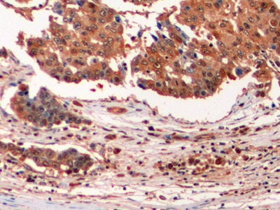 Ubiquitin (Ub) Monoclonal Antibody - image 4