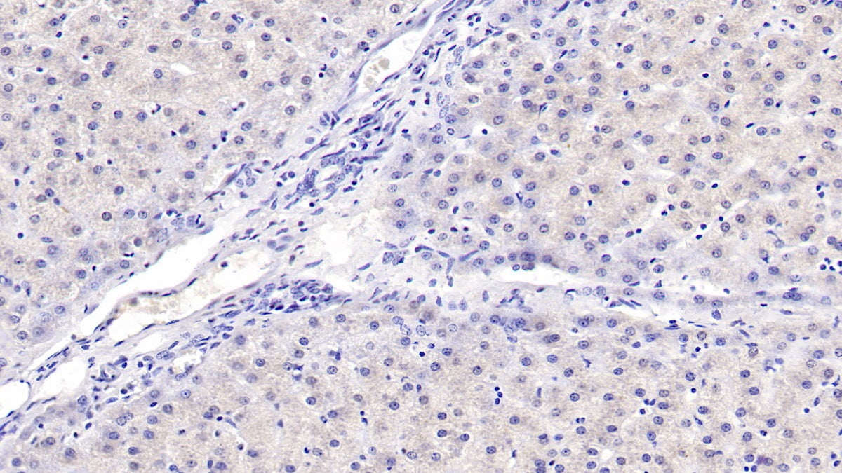 DAB staining on IHC-P; Samples: Human Kidney Tissue;  Primary Ab: 40µg/ml Mouse Anti-Human aHSP Antibody Second Ab: 2µg/mL HRP-Linked Caprine Anti-Mouse IgG Polyclonal Antibody