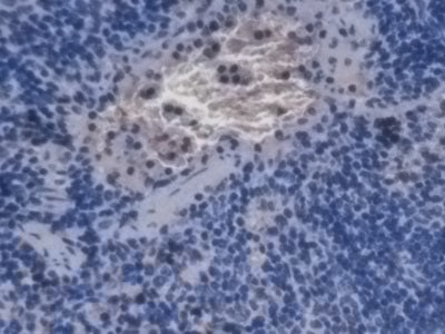Alpha-Hemoglobin Stabilizing Protein (aHSP) Monoclonal Antibody - image 2