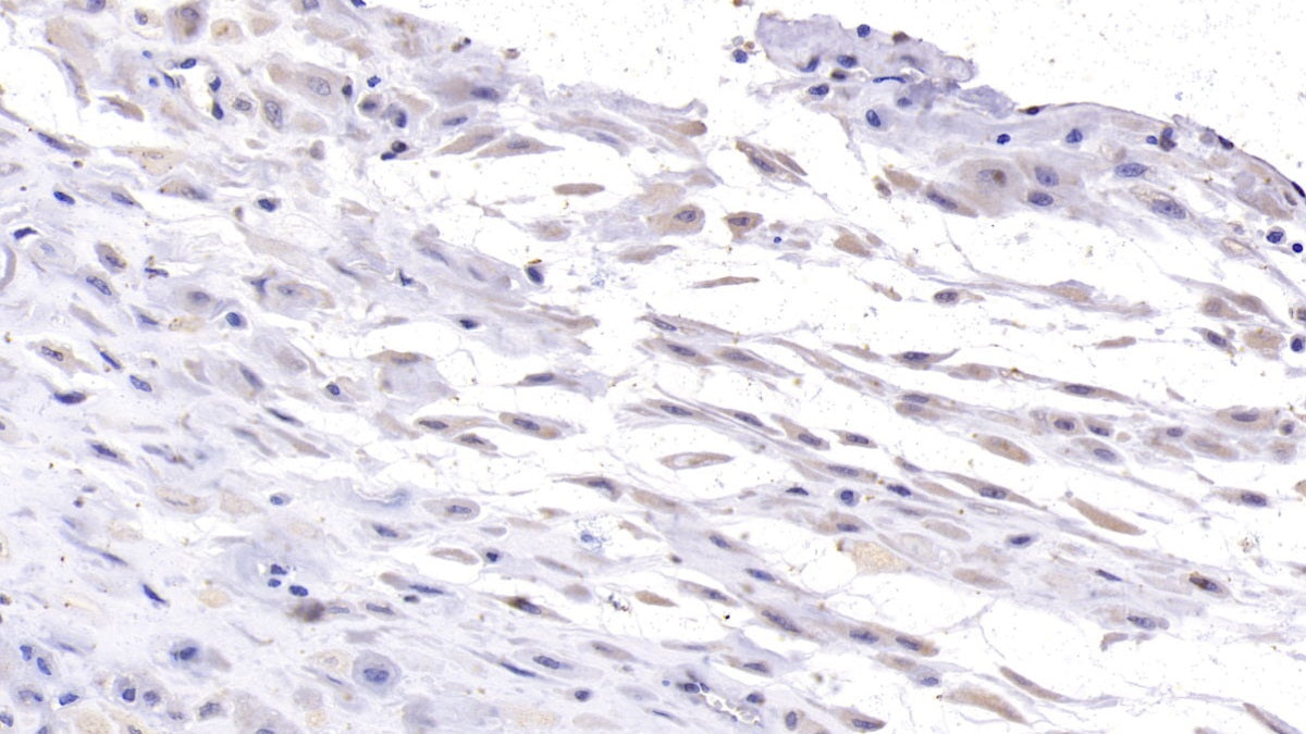Desmoglein 3 (DSG3) Monoclonal Antibody - image 2
