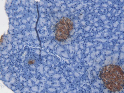 C-Peptide (CP) Monoclonal Antibody - image 2