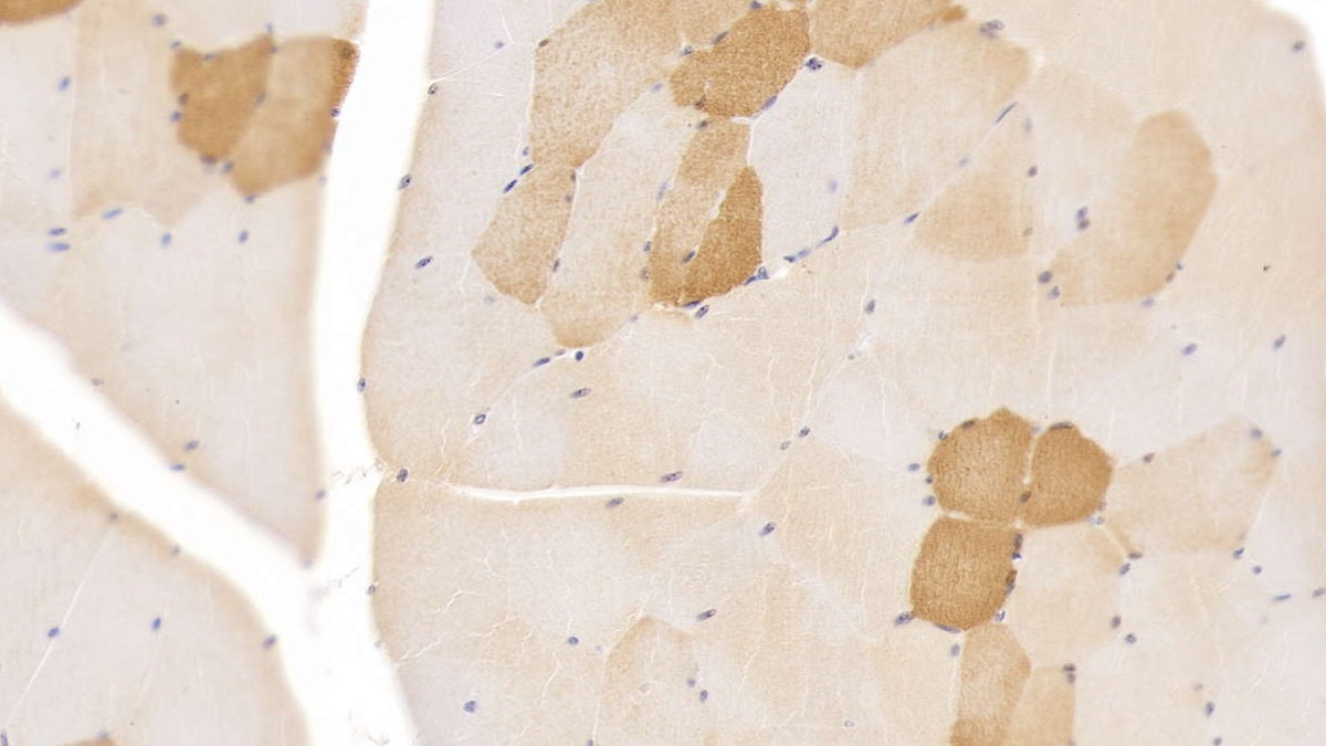 DAB staining on IHC-P; Samples: Human Cardiac Muscle Tissue;  Primary Ab: 20µg/ml Mouse Anti-Human MYO Antibody Second Ab: 2µg/mL HRP-Linked Caprine Anti-Mouse IgG Polyclonal Antibody