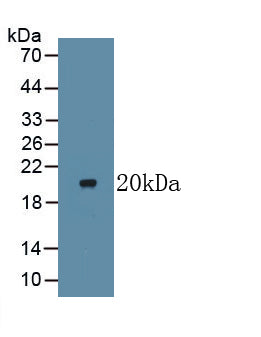 Lymphotoxin Beta Receptor (LTbR) Monoclonal Antibody - image 2