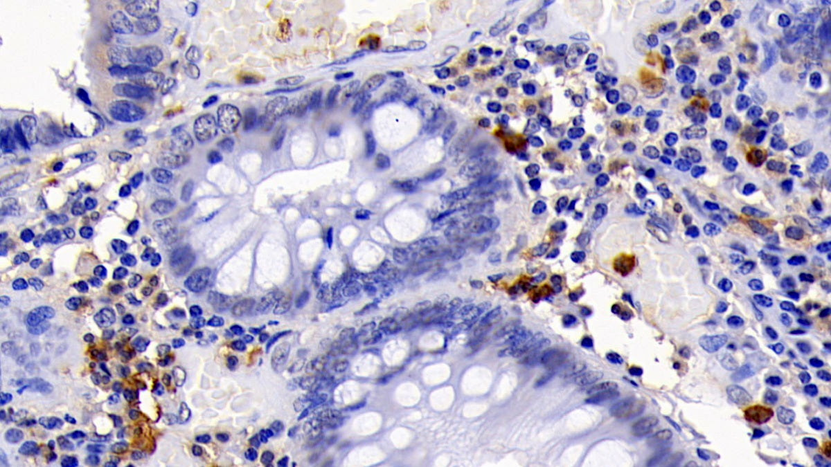 Caspase 3 (CASP3) Monoclonal Antibody - image 3