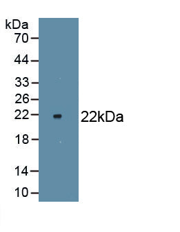 Nitric Oxide Synthase 2, Inducible (NOS2) Monoclonal Antibody - image 2