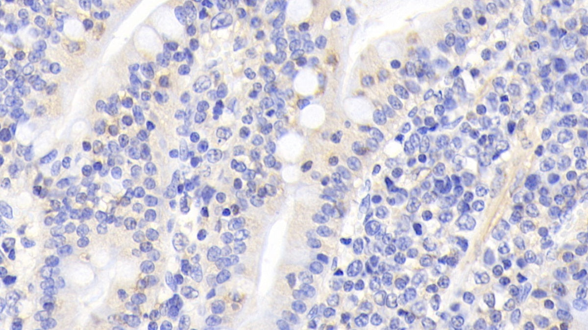 Inhibin Beta A (INHbA) Monoclonal Antibody - image 3