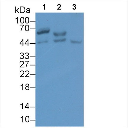 Squamous Cell Carcinoma Antigen 1/2 (SCCA1/SCCA2) Monoclonal Antibody - image 2