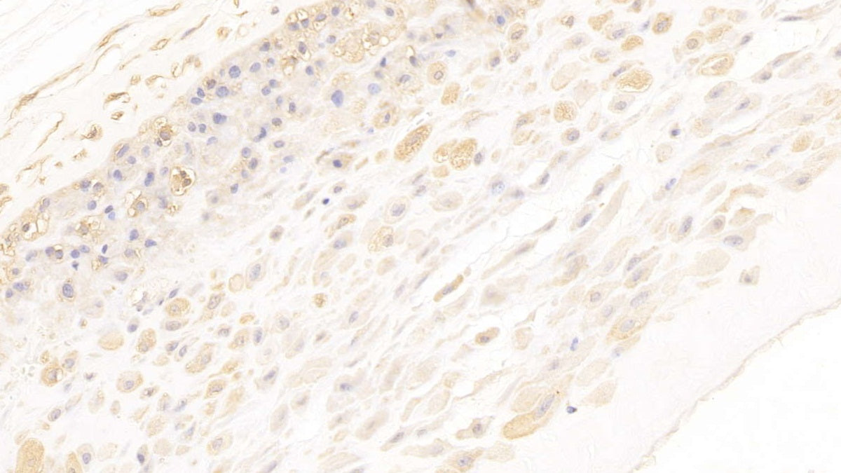 DAB staining on IHC-P; Samples: Human Kidney Tissue;  Primary Ab: 10µg/ml Mouse Anti-Human ANXA2 Antibody Second Ab: 2µg/mL HRP-Linked Caprine Anti-Mouse IgG Polyclonal Antibody