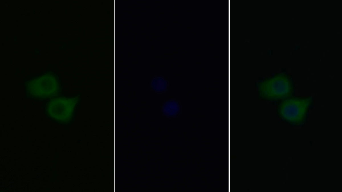 Platelet Derived Growth Factor Receptor Alpha (PDGFRa) Monoclonal Antibody - image 3