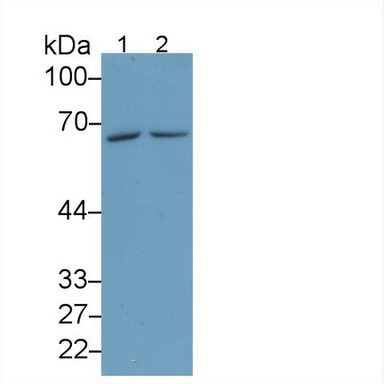 Arginyl tRNA Synthetase (RARS) Monoclonal Antibody - image 2