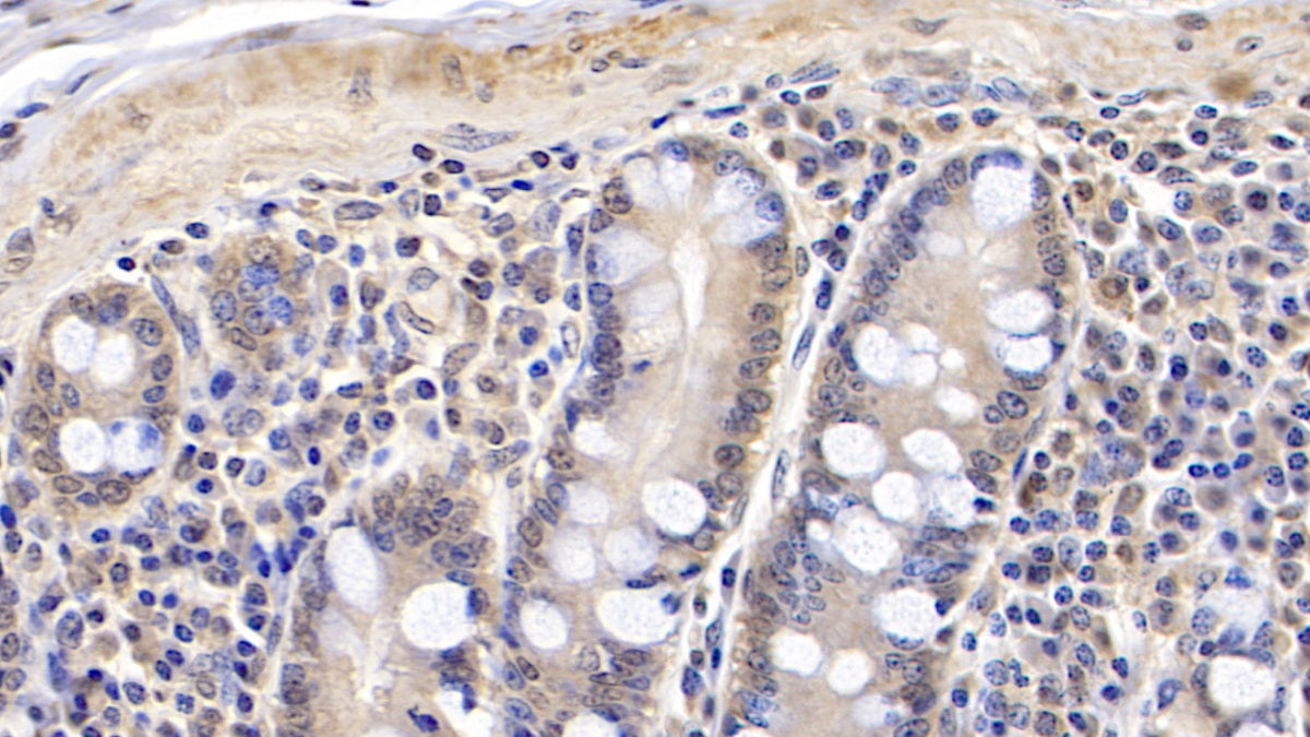 DAB staining on IHC-P; Samples: Human Cerebellum Tissue; Primary Ab: 20µg/ml Mouse Anti-Human RARS Antibody Second Ab: 2µg/mL HRP-Linked Caprine Anti-Mouse IgG Polyclonal Antibody