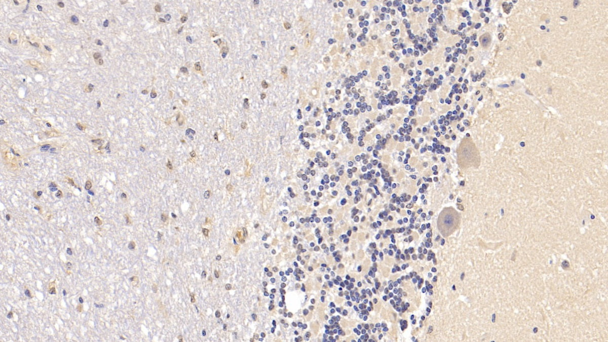 Arginyl tRNA Synthetase (RARS) Monoclonal Antibody - image 4