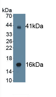 Amiloride Sensitive Sodium Channel Subunit Gamma (SCNN1g) Monoclonal Antibody - image 2