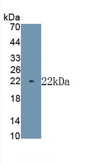 Myosin Heavy Chain 7, Cardiac Muscle, Beta (MYH7) Monoclonal Antibody - image 2