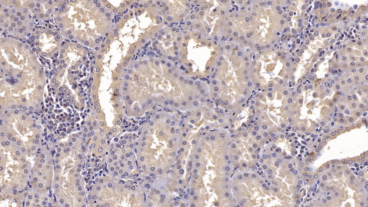 DAB staining on IHC-P; Samples: Human Liver Tissue;  Primary Ab: 10µg/ml Mouse Anti-Human ANXA3 Antibody Second Ab: 2µg/mL HRP-Linked Caprine Anti-Mouse IgG Polyclonal Antibody