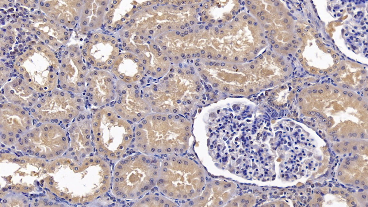 Annexin A3 (ANXA3) Monoclonal Antibody - image 4