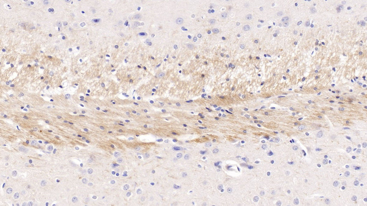 DAB staining on IHC-P; Samples: Rat Spinal cord Tissue;  Primary Ab: 10ug/ml Mouse Anti-Rat CDNF Antibody Second Ab: 2µg/mL HRP-Linked Caprine Anti-Mouse IgG Polyclonal Antibody