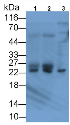 Parkinson Disease Protein 7 (PARK7) Monoclonal Antibody - image 2