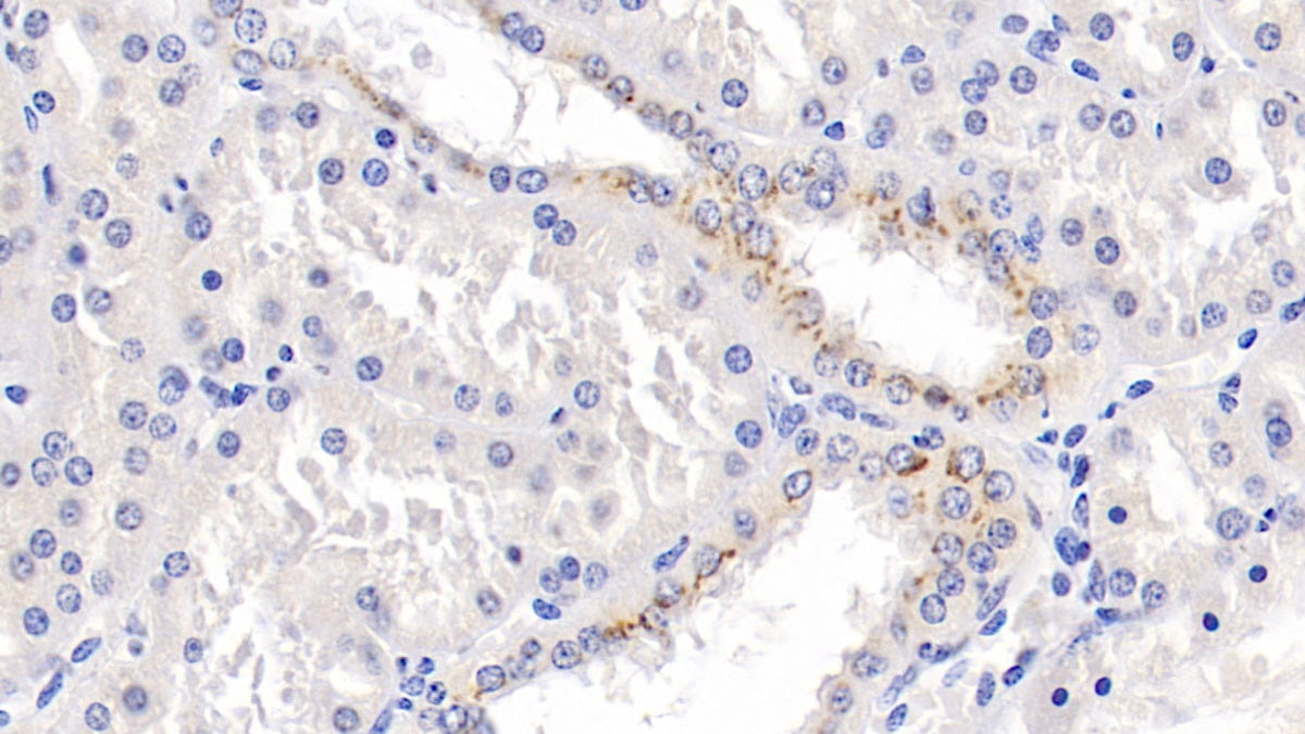 Parkinson Disease Protein 7 (PARK7) Monoclonal Antibody - image 3