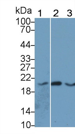 Angiopoietin Like Protein 8 (ANGPTL8) Monoclonal Antibody - image 2