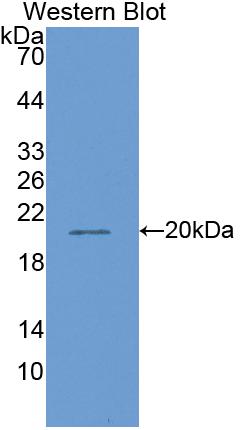 Matrix Metalloproteinase 13 (MMP13) Polyclonal Antibody - image 2