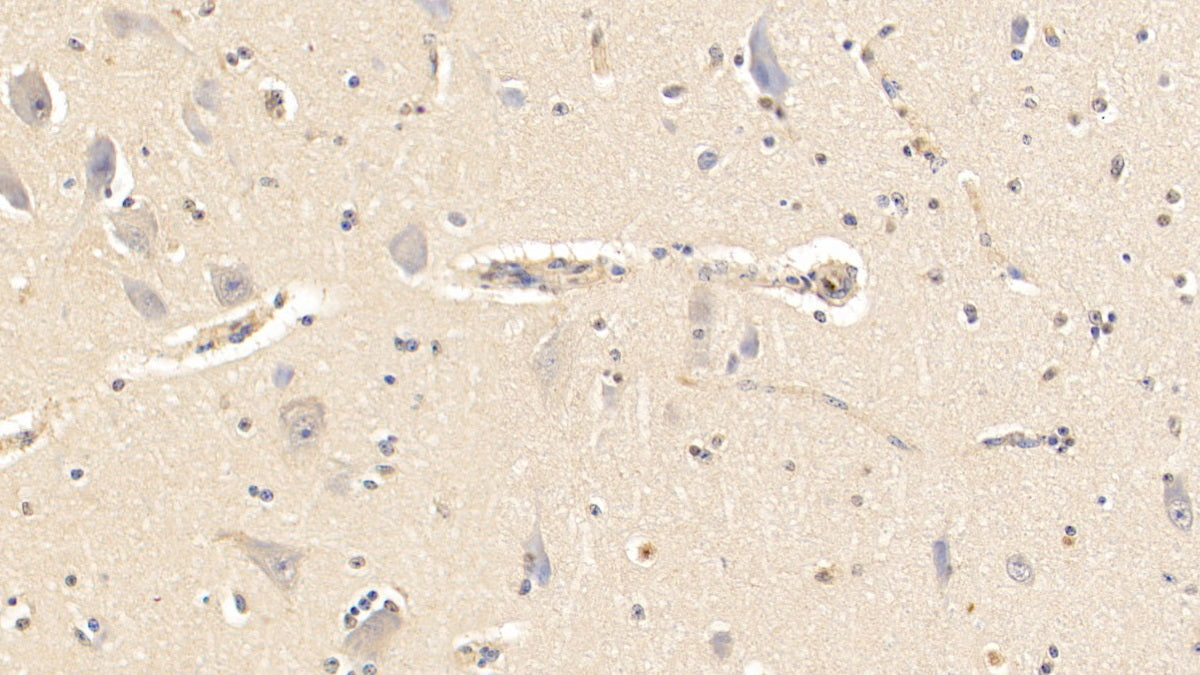 DAB staining on IHC-P; Samples: Bovine Cerebrum Tissue; Primary Ab: 20μg/ml Rabbit Anti-Bovine aHSG Antibody Second Ab: 2µg/mL HRP-Linked Caprine Anti-Rabbit IgG Polyclonal Antibody