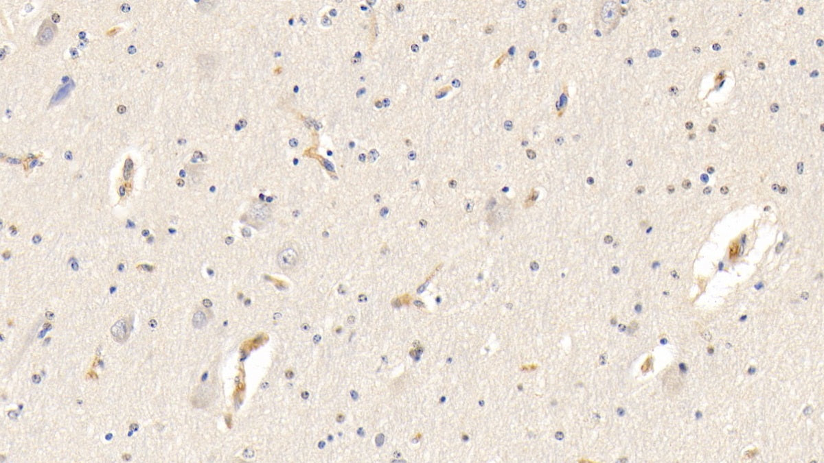 Alpha-2-Heremans Schmid Glycoprotein (AHSG) Polyclonal Antibody - image 4
