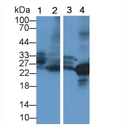 Neutrophil Elastase (NE) Polyclonal Antibody - image 2