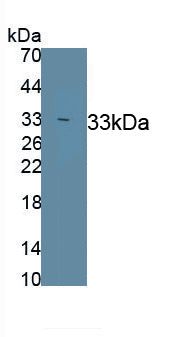 Neuronal Pentraxin II (NPTX2) Polyclonal Antibody - image 2