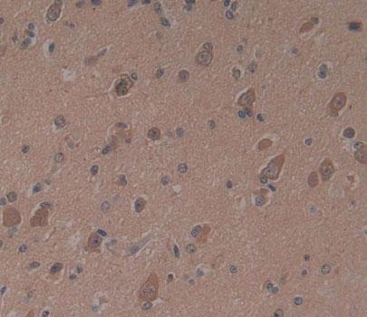 Proteasome subunit beta type-9 (PSMB9) Polyclonal Antibody - image 3
