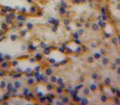 Luteinizing Hormone (LH) Polyclonal Antibody - image 3