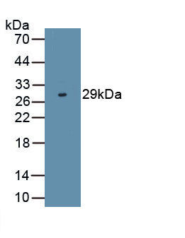 N-Terminal Pro-Brain Natriuretic Peptide (NT-ProBNP) Polyclonal Antibody - image 2