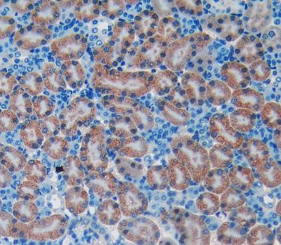 Brain Natriuretic Peptide (BNP) Polyclonal Antibody - image 3