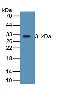 Myosin Heavy Chain 2 (MYH2) Polyclonal Antibody - image 2