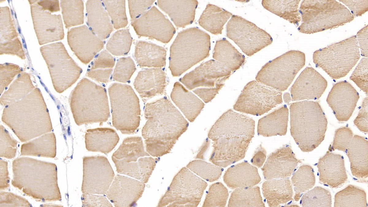 DAB staining on IHC-P; Samples: Human Cardiac Muscle Tissue;  Primary Ab: 10µg/ml Rabbit Anti-Human MYH2 Antibody Second Ab: 2µg/mL HRP-Linked Caprine Anti-Rabbit IgG Polyclonal Antibody