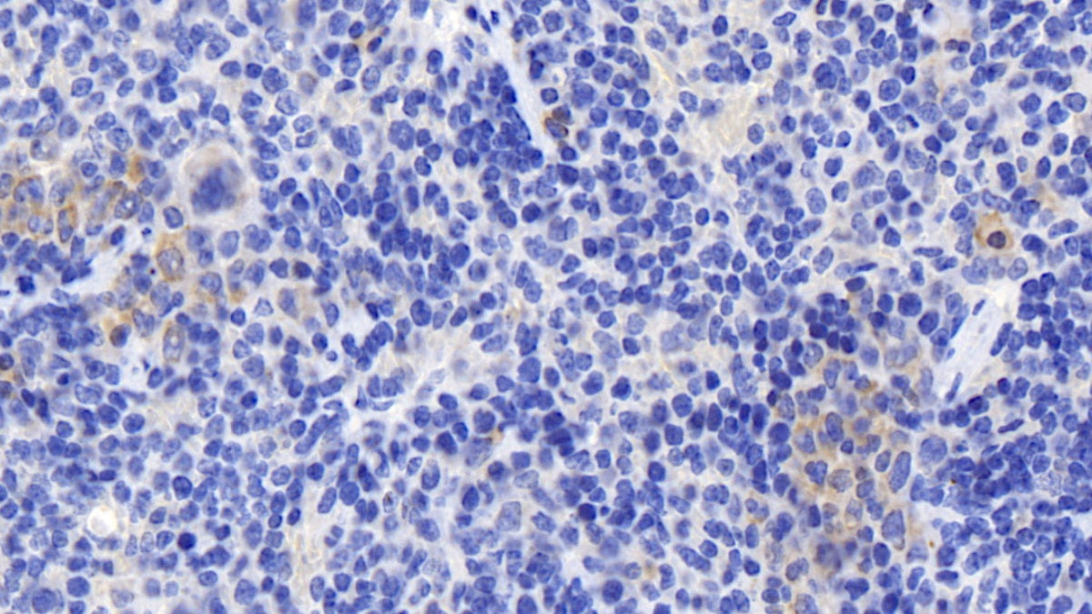 Chemokine C-X-C-Motif Ligand 16 (CXCL16) Polyclonal Antibody - image 3