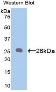 B-Cell Leukemia/Lymphoma 2 (Bcl2) Polyclonal Antibody - image 2