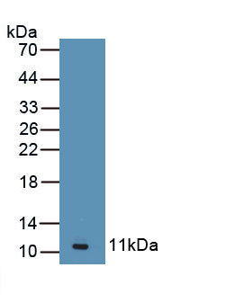 Angiotensin II Receptor 2 (AGTR2) Polyclonal Antibody - image 2